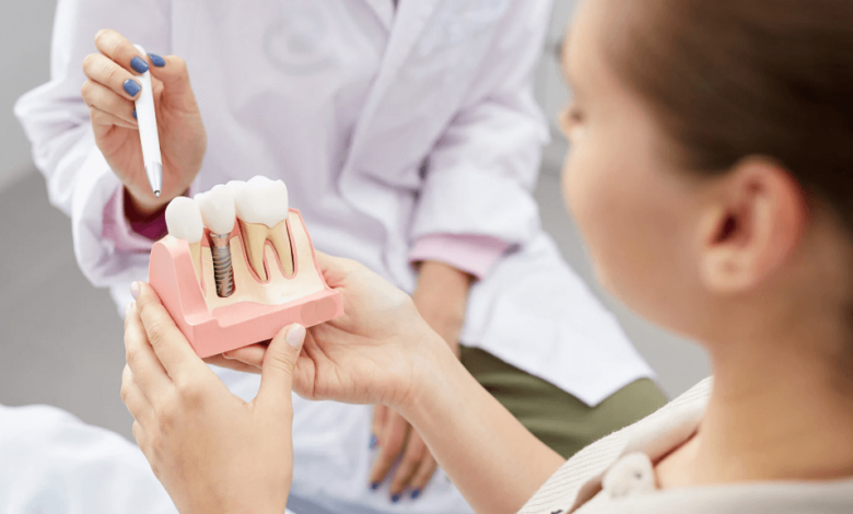 Exploring Advanced Options for Tooth Replacement