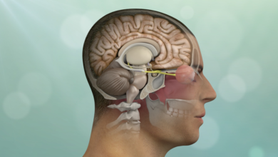 Brain Tumors Explained: Symptoms, Diagnosis, and Recovery