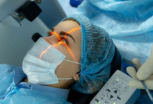 Is Laser Eye Surgery Safe? Myths and Facts Explained