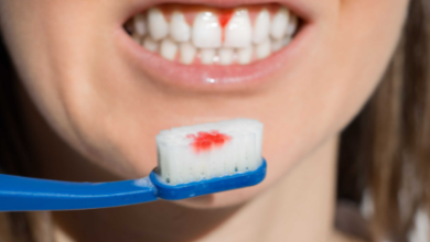 Bleeding Gums? Here's When to Worry