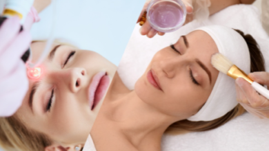 Chemical Peels vs Laser for Pigmentation – Which Is Better?