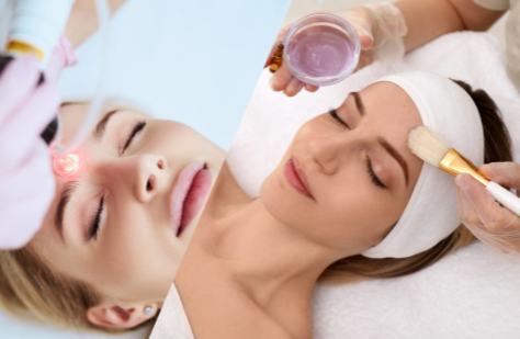 Chemical Peels vs Laser for Pigmentation – Which Is Better?