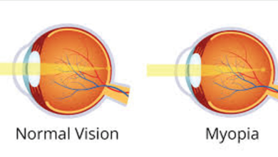 Lifestyle Tips from Myopia Clinics to Slow Down Nearsightedness