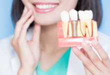 Dental Implant Clinic in Korea: Everything You Need to Know