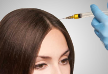 How to Restore Hair Naturally with PRP Therapy