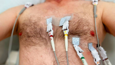 Caring for Every Heartbeat: Why Regular Cardiac Checkups Matter More Than Ever