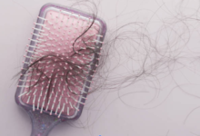 Comprehensive Hair Restoration Services in Essex Locations