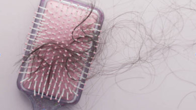 Comprehensive Hair Restoration Services in Essex Locations