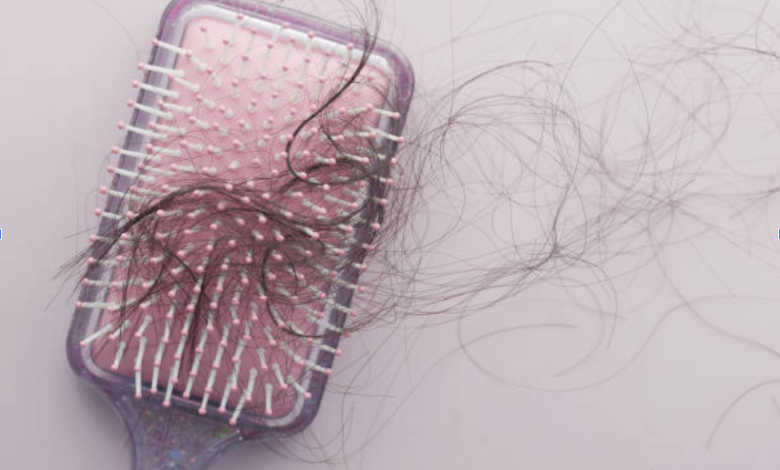 Comprehensive Hair Restoration Services in Essex Locations