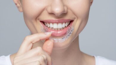 Invisalign in Glendale