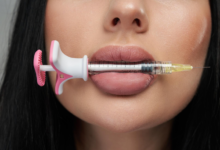 From Consultation to Results: What to Expect For Lip Filler Injections